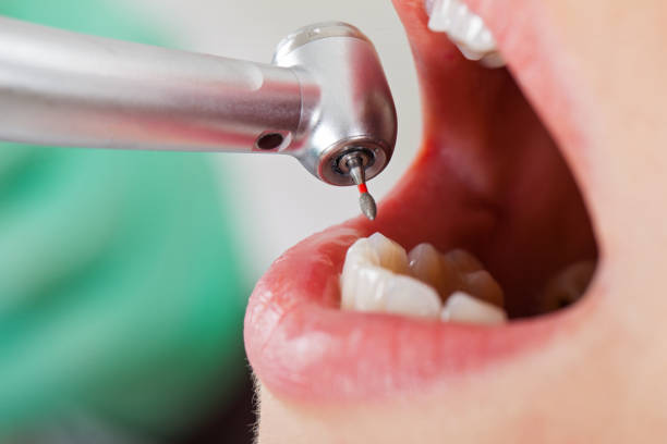 Best Teeth Whitening  in Warner, OK